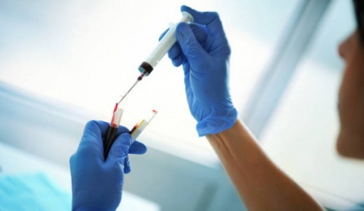 Test per Benzodiazepine Matrice Pilifera 