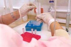 Papilloma virus DNA HPV qualitativo | Zona Ferrara