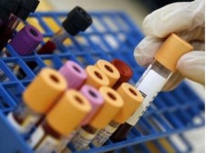 Test Fibrosi Cistica DNA Mutazione 35 Alleli - Ferrara