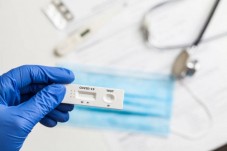 Test Quantitativo IGG Neutralizzanti Covid 19